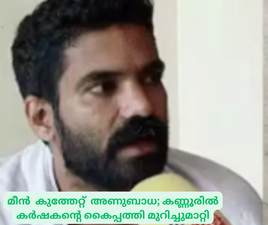 മീൻ  കുത്തേറ്റ്  അണുബാധ; കണ്ണൂരിൽ  കർഷകന്റെ കൈപ്പത്തി മുറിച്ചുമാറ്റി