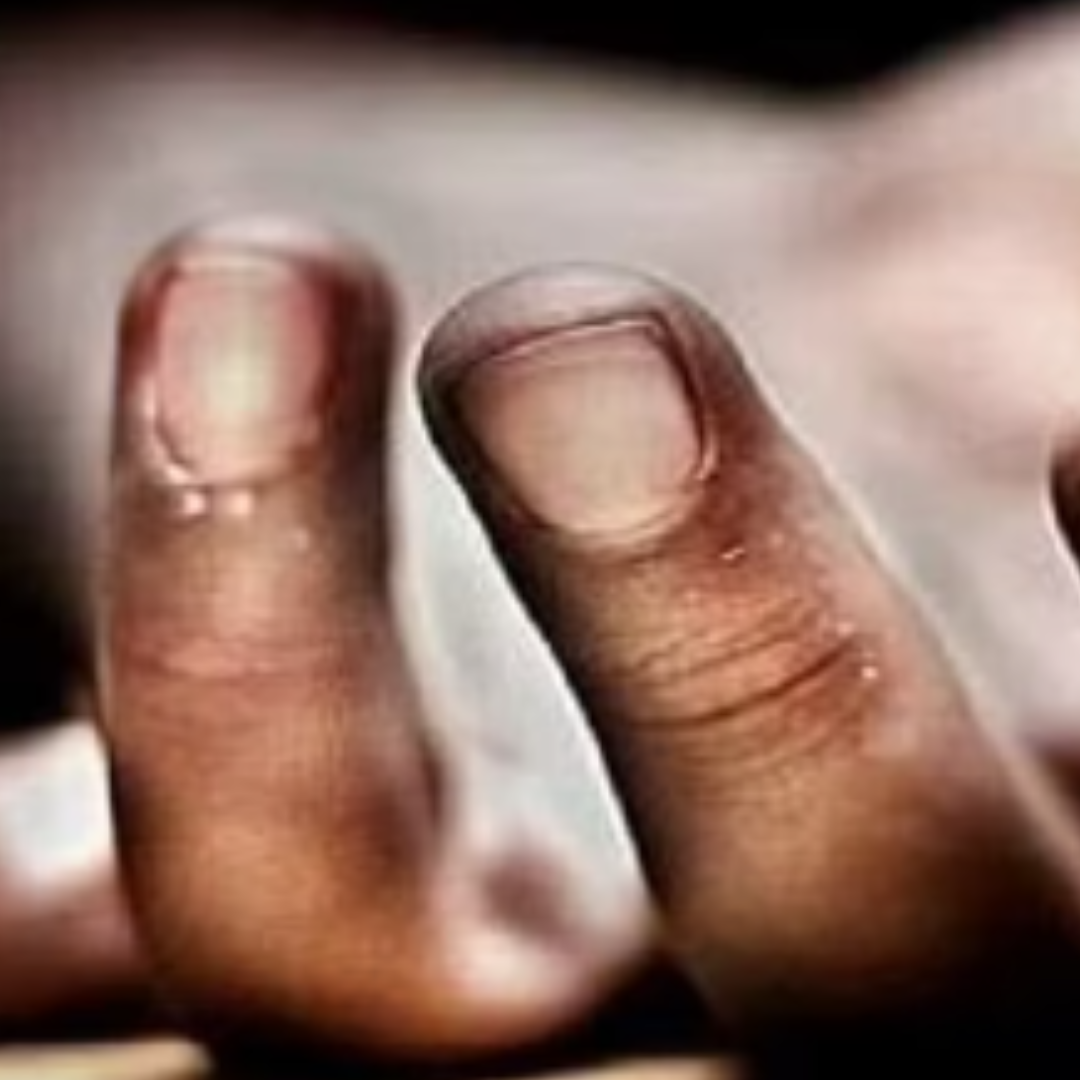 കാട്ടാനയെ കണ്ട് ഭയന്നോടിയയാൾ കുഴഞ്ഞുവീണ് മരിച്ചു;  മരണം രാത്രി വൈകി  വീടിന് സമീപം എത്തിയ കാട്ടാനയെ ഓടിക്കുന്നതിനിടെ