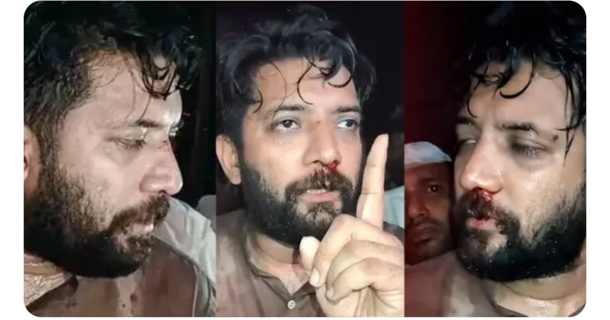 ഷാഫി പറമ്പിൽ എംപിക്ക് പേരാമ്പ്രയിൽ മർദ്ദനമേറ്റ സംഭവം ; സംസ്ഥാനത്തോട് റിപ്പോര്‍ട്ട് തേടാന്‍ കേന്ദ്ര ആഭ്യന്തര മന്ത്രാലയത്തിന് ലോക്‌സഭാ സെക്രട്ടറിയേറ്റ് നിര്‍ദേശം