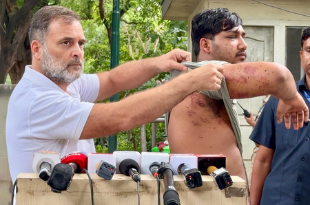 നീറ്റ് സമരത്തിൽ പ്രതിഷേധക്കാർക്ക് നേരെ പെല്ലറ്റ് ഗൺ പ്രയോഗം; സിആർപിഎഫ് അന്വേഷണം ഊർജിതമാക്കി